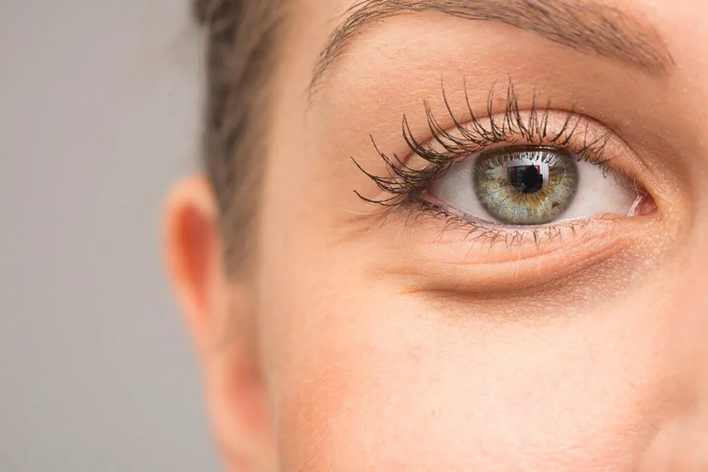 Causes of bags and dark circles under the lower eyelids 