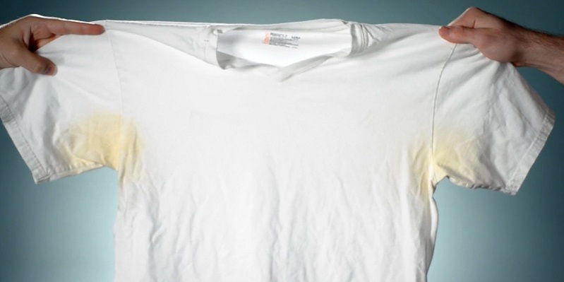 How to remove yellow spots from white items 